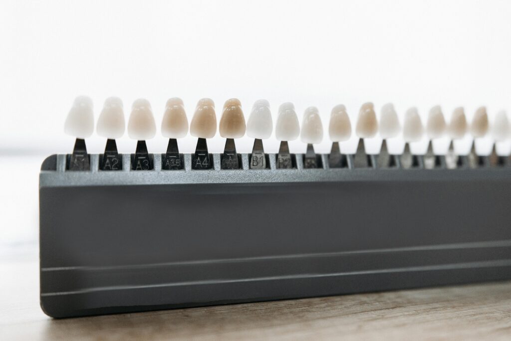 Detailed view of dental veneer shade guide for matching tooth color.